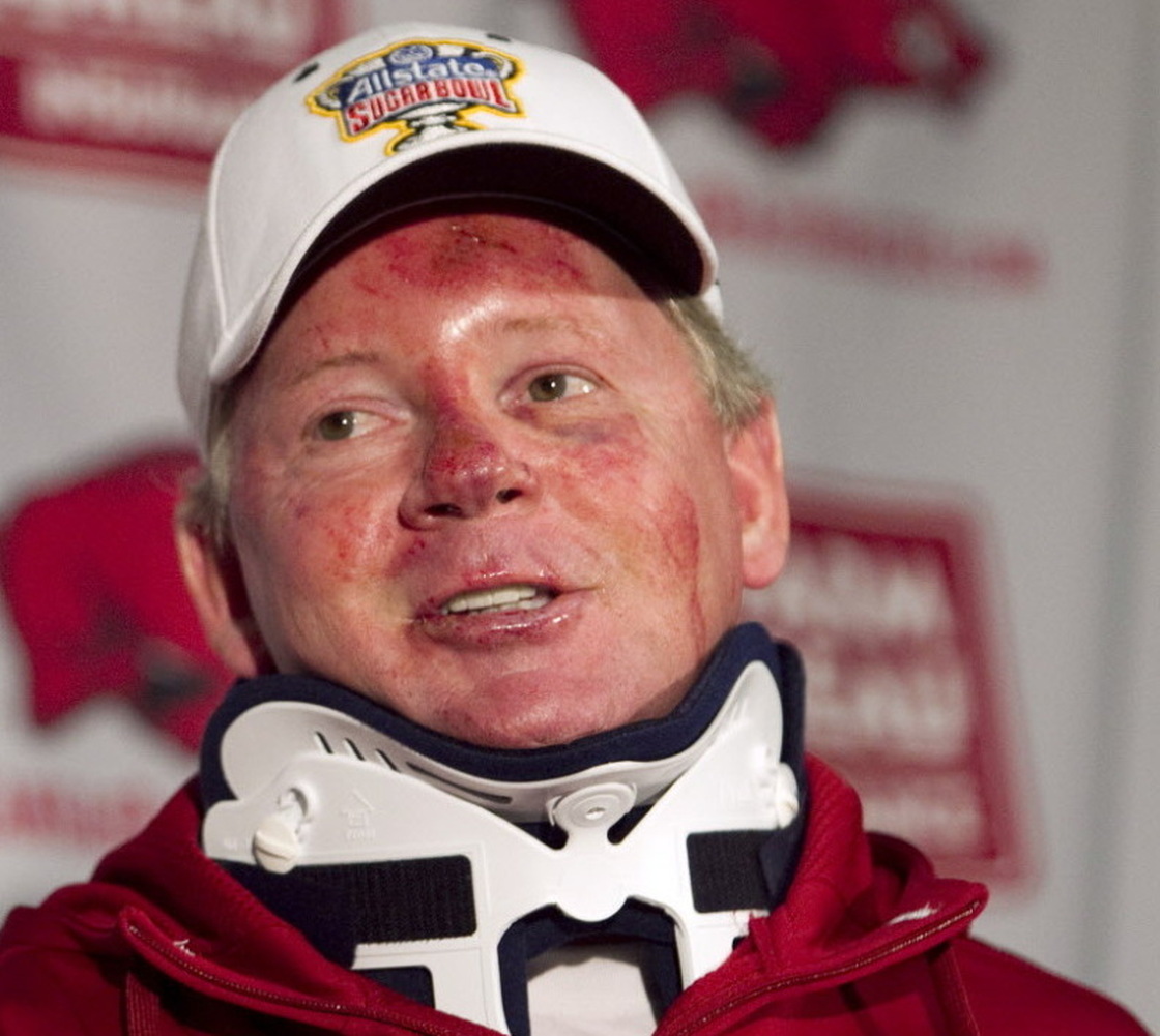 Dismissed Arkansas football coach Bobby Petrino at an April 3 news conference, following his release from a hospital where he was treated for injuries suffered in a motorcycle accident. That mishap led to the revealing of his affair with a younger woman, payments he made to her and that he had arranged for her to get a job at the university. 