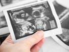 According to the Society for Assisted Reproductive Technology, more than 1,400 U.S. babies were born through surrogacy in 2010. According to the Society for Assisted Reproductive Technology, more than 1,400 U.S. babies were born through surrogacy in 2010.