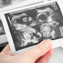  According to the Society for Assisted Reproductive Technology, more than 1,400 U.S. babies were born through surrogacy in 2010. 