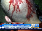 A photograph, ABC News says shows blood on George Zimmerman's head. A photograph, ABC News says shows blood on George Zimmerman's head.