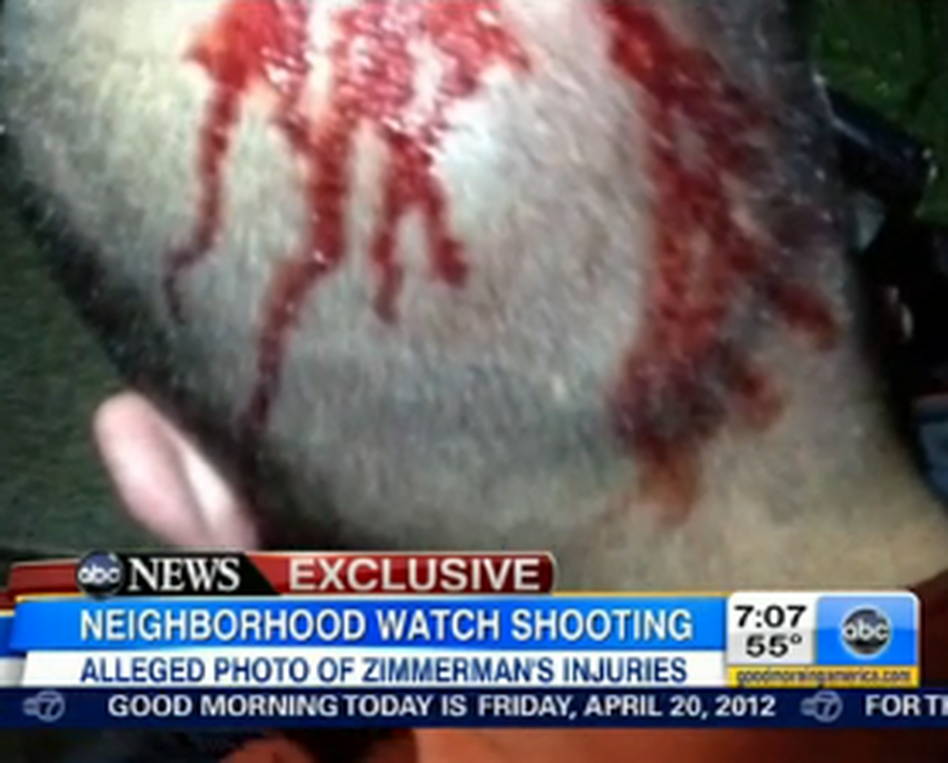 A photograph, ABC News says shows blood on George Zimmerman's head.