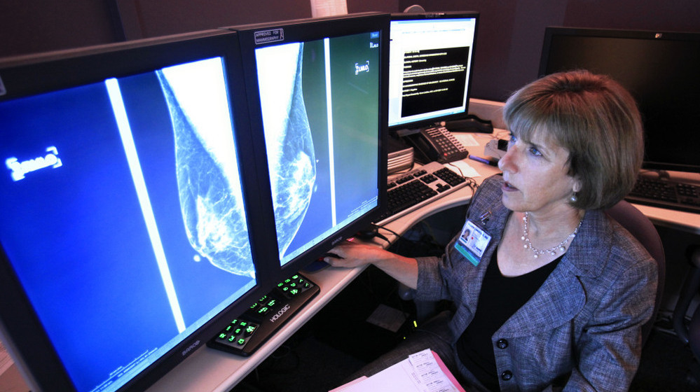 Karen Lindsfor, a professor of radiology and chief of breast imaging at the University of California, Davis Medical Center, examines the mammogram of a patient with heterogeneously dense breast tissue. Lindfors is among those doctors who say there was insufficient evidence to support the idea that additional screenings would detect cancers earlier.
