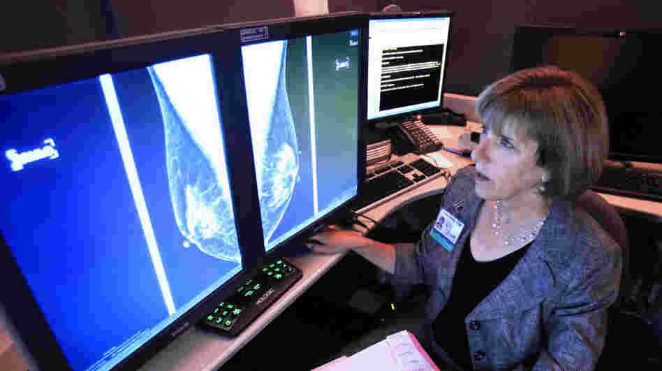 Karen Lindsfor, a professor of radiology and chief of breast imaging at the University of California, Davis Medical Center, examines the mammogram of a patient with heterogeneously dense breast tissue. Lindfors is among those doctors who say there was insufficient evidence to support the idea that additional screenings would detect cancers earlier.