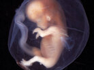 Human embryo Human embryo