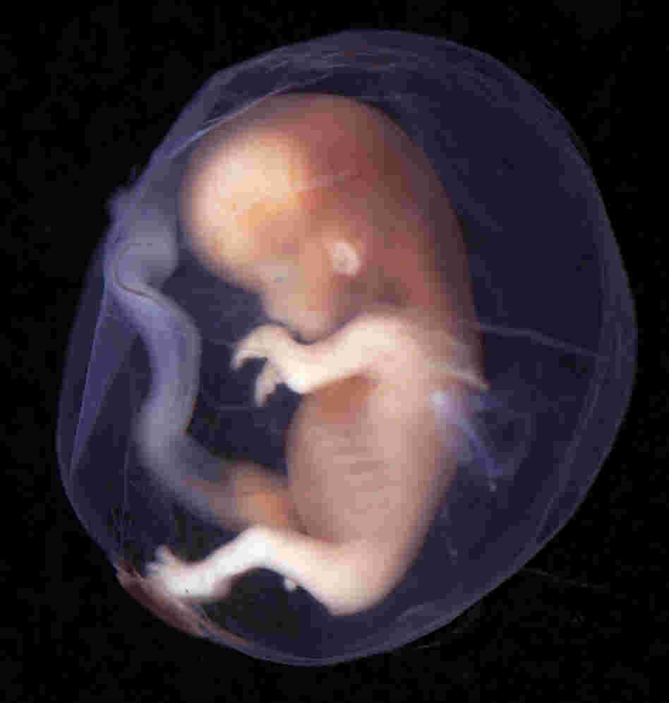 Human embryo Human embryo