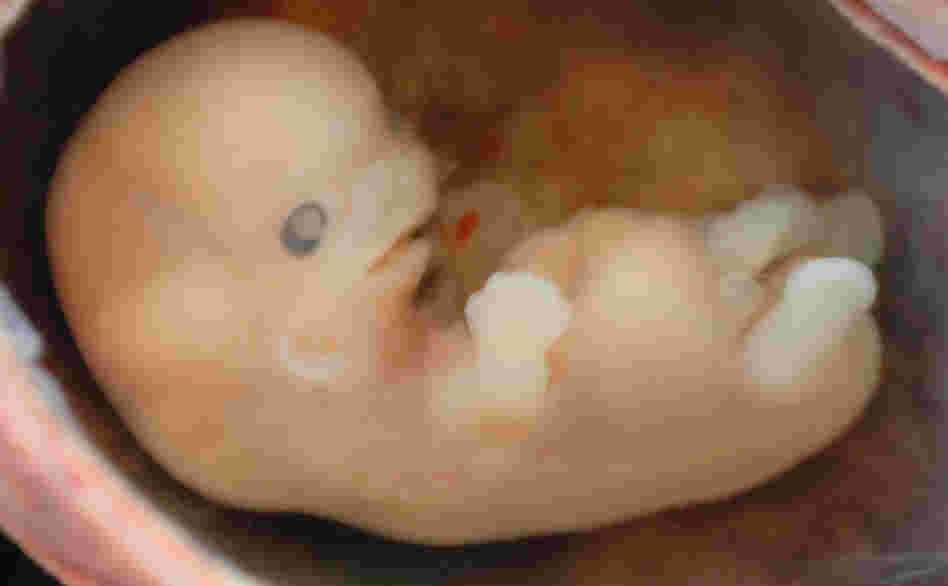 Human embryo Human embryo