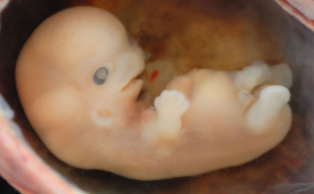 Embryo-2_custom