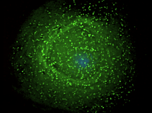 HIV particles assemble at the surface of a white blood cell called a macrophage. HIV particles assemble at the surface of a white blood cell called a macrophage.