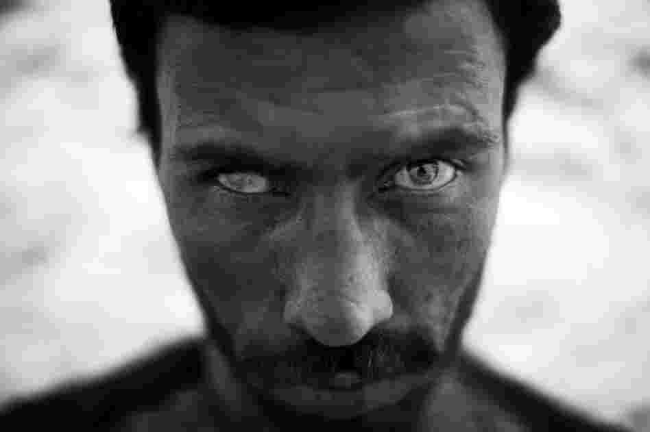Manullah Ahmadzai, 27, lost the sight in his right eye while serving as a front-line soldier in the Afghan military. Ahmadzai is one of many soldiers who have been severely injured and say promised government benefits don't always arrive.