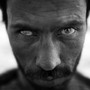 Manullah Ahmadzai, 27, lost the sight in his right eye while serving as a front-line soldier in the Afghan military. Ahmadzai is one of many soldiers who have been severely injured and say promised government benefits don't always arrive.
