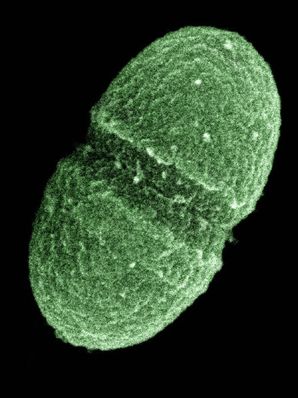 The bacterium Enterococcus faecalis is a beautiful example of a gut microbe.