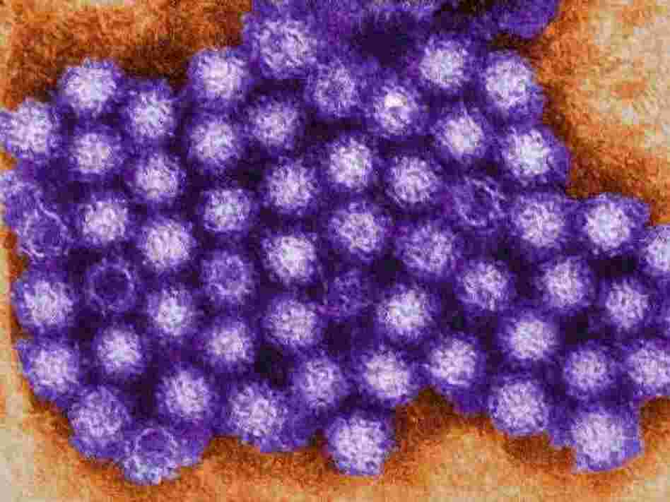 An electron micrograph of human norovirus.