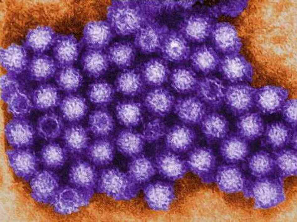 An electron micrograph of human norovirus.