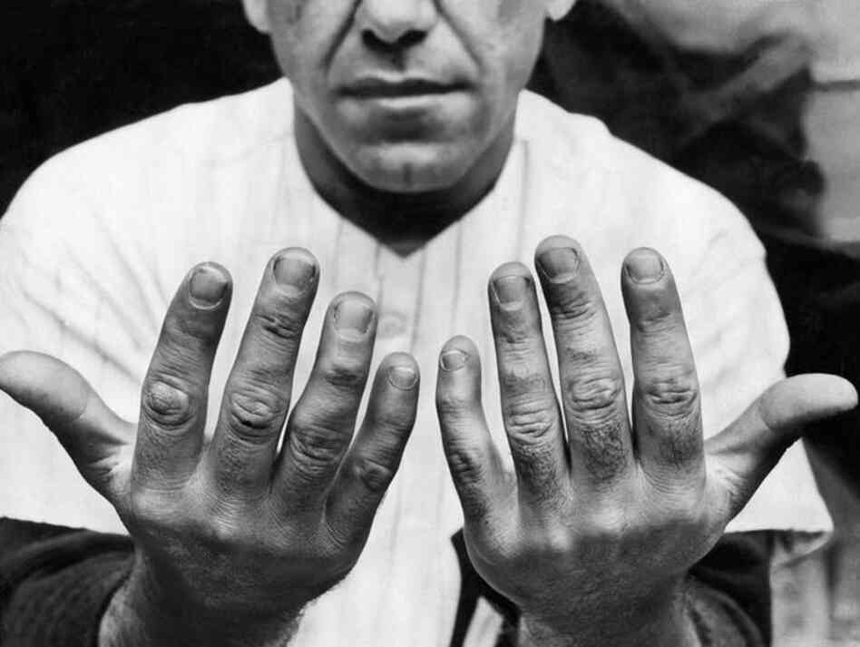Oct. 7, 1956: Yogi Berra's hands were the focus of an article titled "Hands of Catchers Take Battering," published five days after the photo was taken. "These catchers' hands will win no beauty prize," the reporter wrote, "but as functional implements they rate special awards."