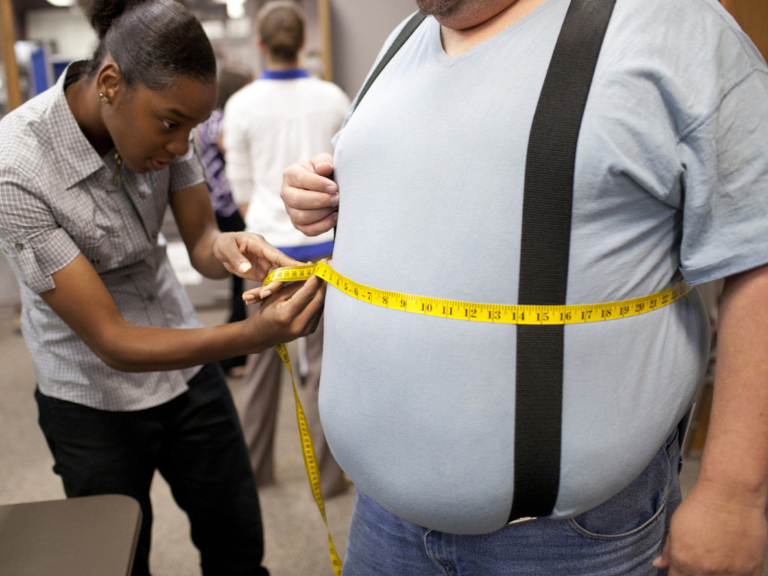 In the United States, more than 78 million adults and 12 million children are obese.