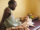 Nyachieng Nguot Teng, 25, lost her left leg and her 7-month-old son suffered a fractured leg when a Sudanese bomb fell on her hut in Lalat, South Sudan, on May 5. The United Nations is trying to prevent the recent fighting between the two Sudans from escalating into full-scale war. Nyachieng Nguot Teng, 25, lost her left leg and her 7-month-old son suffered a fractured leg when a Sudanese bomb fell on her hut in Lalat, South Sudan, on May 5. The United Nations is trying to prevent the recent fighting between the two Sudans from escalating into full-scale war.