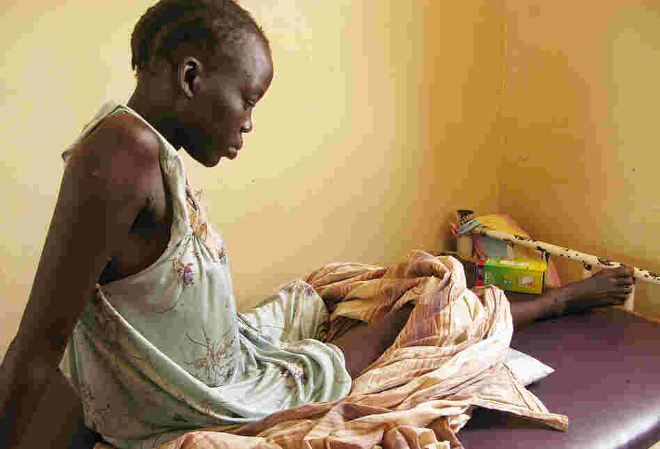 Nyachieng Nguot Teng, 25, lost her left leg and her 7-month-old son suffered a fractured leg when a Sudanese bomb fell on her hut in Lalat, South Sudan, on May 5. The United Nations is trying to prevent the recent fighting between the two Sudans from escalating into full-scale war.