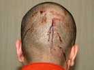 A photograph of George Zimmerman's head taken after the Feb. 26 shooting death of Trayvon Martin. It shows blood from injuries he Zimmerman says he received during their encounter. A photograph of George Zimmerman's head taken after the Feb. 26 shooting death of Trayvon Martin. It shows blood from injuries he Zimmerman says he received during their encounter.