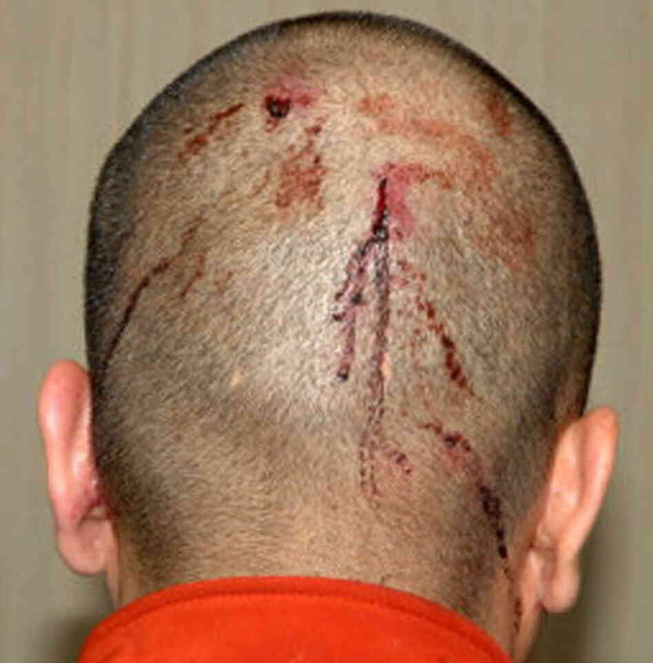 A photograph of George Zimmerman's head taken after the Feb. 26 shooting death of Trayvon Martin. It shows blood from injuries he Zimmerman says he received during their encounter.