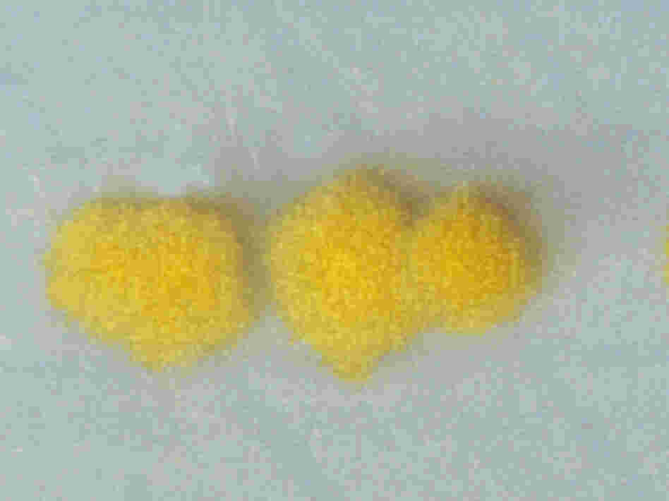 Colonies of Clostridium difficile look awfully nice, but they're definitely something you'd be advised to keep at a safe distance. Colonies of Clostridium difficile look awfully nice, but they're definitely something you'd be advised to keep at a safe distance.