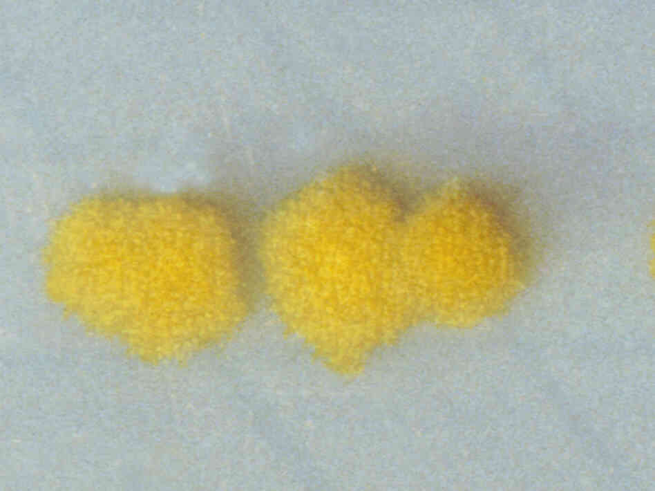 Colonies of Clostridium difficile look awfully nice, but they're definitely something you'd be advised to keep at a safe distance. Colonies of Clostridium difficile look awfully nice, but they're definitely something you'd be advised to keep at a safe distance.