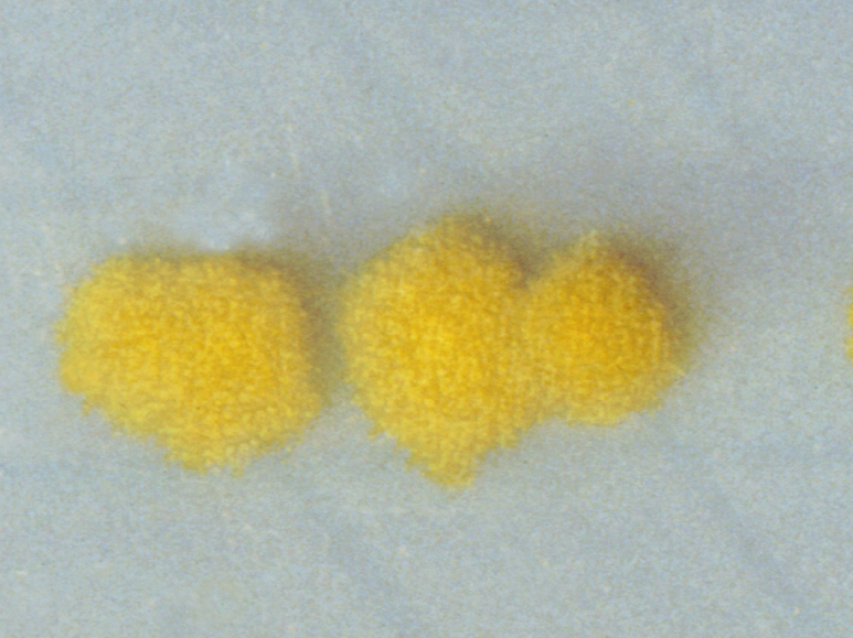 Colonies of <em>Clostridium difficile </em>look awfully nice, but they're definitely something you'd be advised to keep at a safe distance.