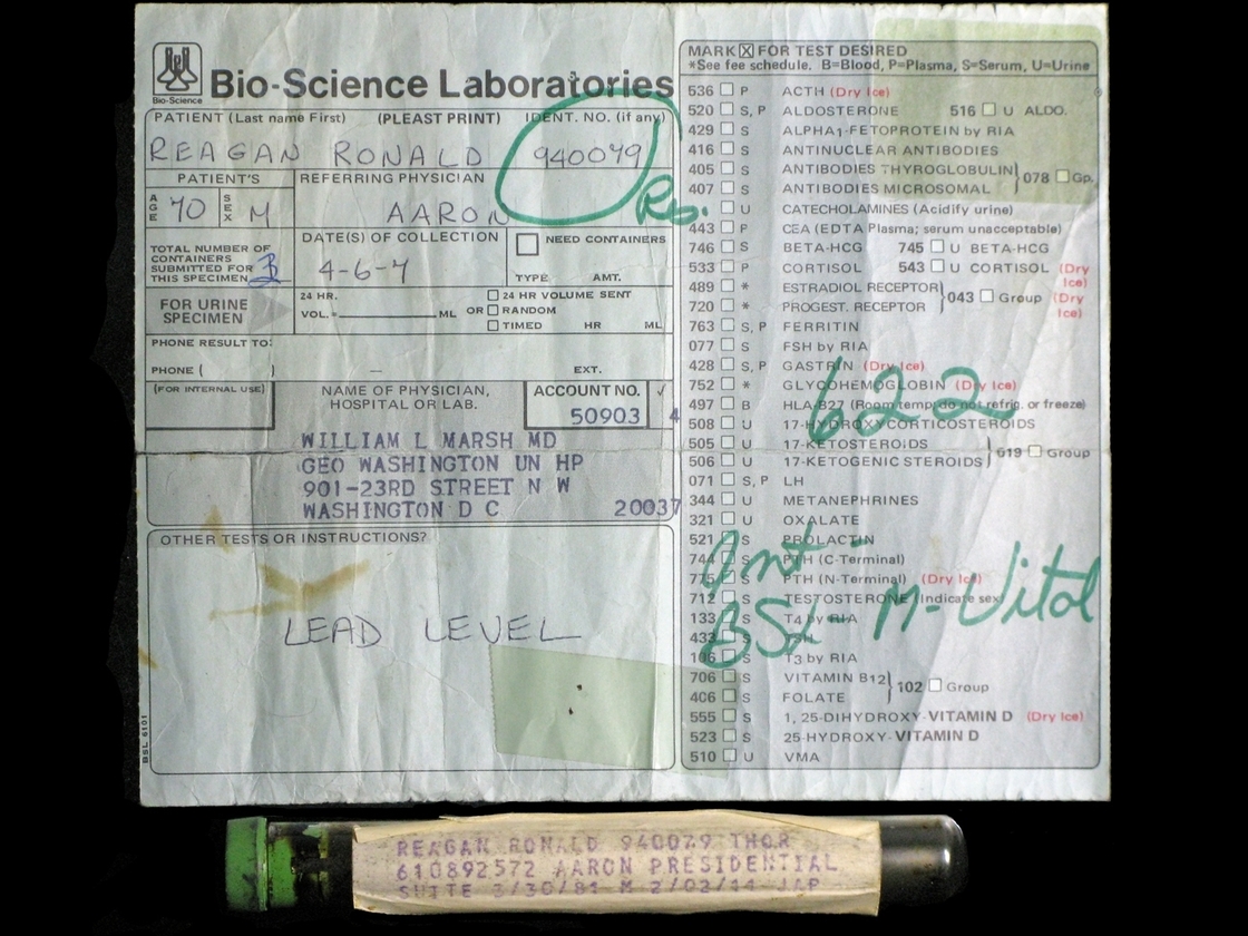 This vial, purportedly containing Ronald Reagan's dried blood residue, is being auctioned by a British website. The auction has angered some, including Reagan's family and the foundation that runs his presidential library.
