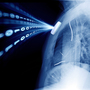 Hugo Campos' implantable cardioverter-defibrillator was a mystery to him. So he decided to ask his doctor for access to the data. He made this image with one of his own X-rays.