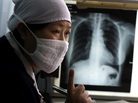 Gao Weiwei, a doctor of the Beijing Chest Hospital which specializes in the treatment of tuberculosis, talks to a patient suspected to have tuberculosis at the hospital in Tongzhou, near Beijing, March 27, 2009. Gao Weiwei, a doctor of the Beijing Chest Hospital which specializes in the treatment of tuberculosis, talks to a patient suspected to have tuberculosis at the hospital in Tongzhou, near Beijing, March 27, 2009.