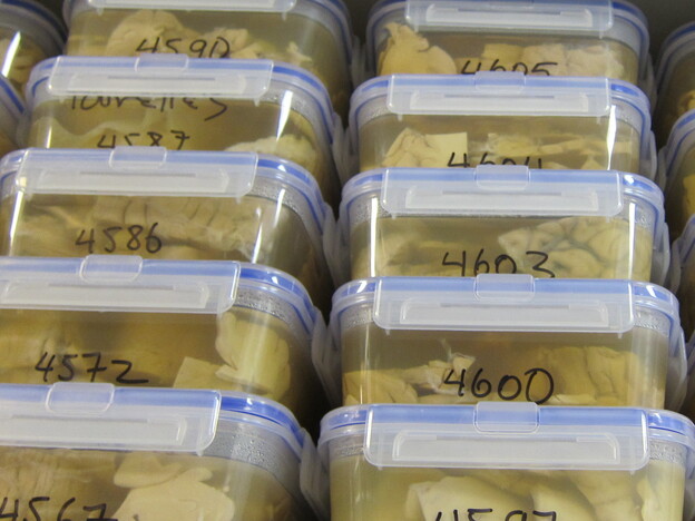 Unrefrigerated brains in preserving solution are stacked high on shelves at the Harvard Brain Tissue Resource Center at McLean Hospital.