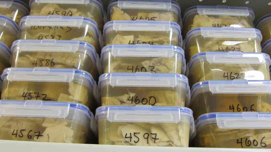 Unrefrigerated brains in preserving solution are stacked high on shelves at the Harvard Brain Tissue Resource Center at McLean Hospital.