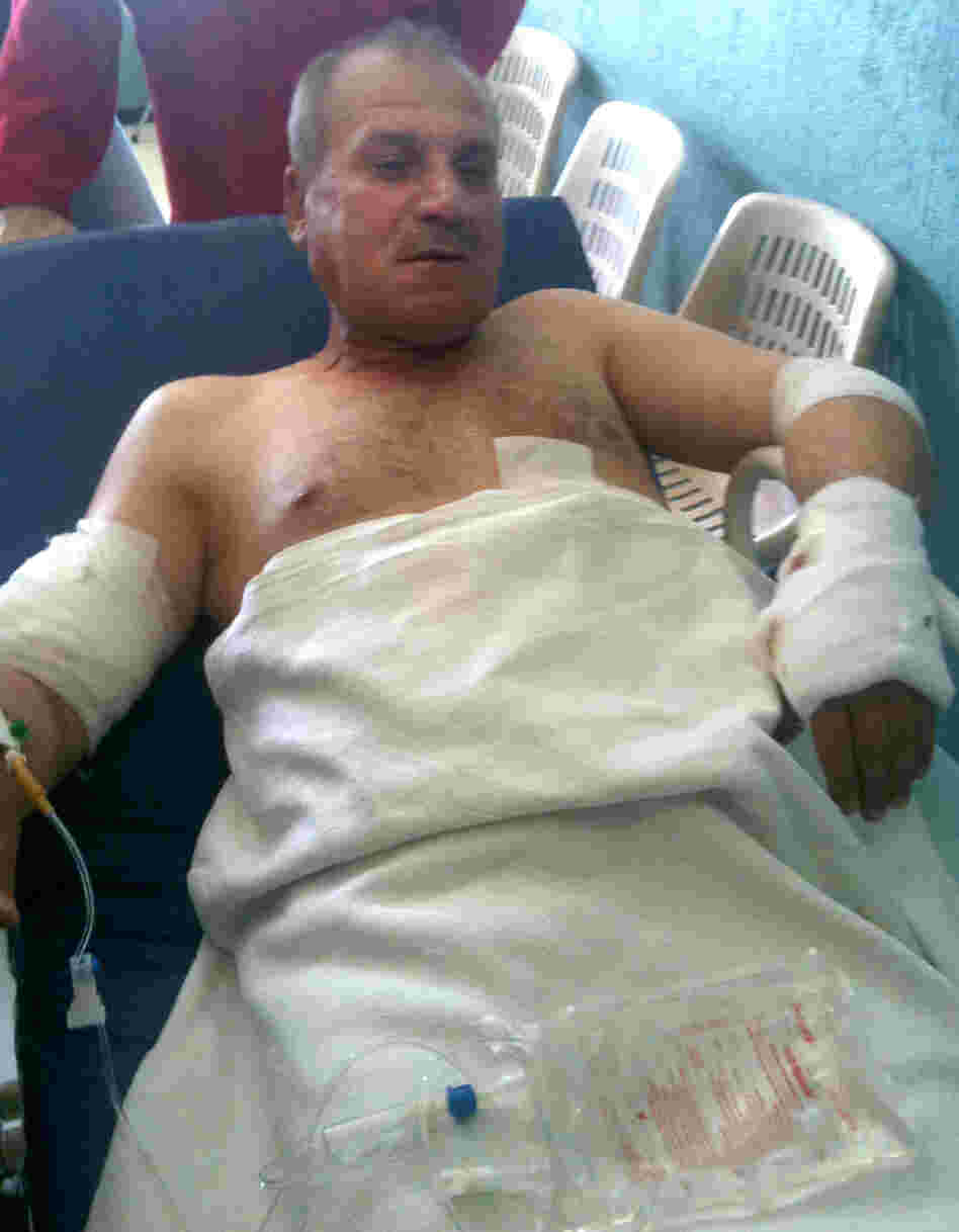 Col. Abdul Kareem Mustapha, 51, is being treated at Barzeh military hospital in Damascus. He was wounded in the Syrian capital Tuesday during an ambush by armed men in taxis that killed one of his fellow passengers. Col. Abdul Kareem Mustapha, 51, is being treated at Barzeh military hospital in Damascus. He was wounded in the Syrian capital Tuesday during an ambush by armed men in taxis that killed one of his fellow passengers.