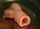 The section of trachea with two days of cell growth, immediately before Castillo's implant surgery. The section of trachea with two days of cell growth, immediately before Castillo's implant surgery.