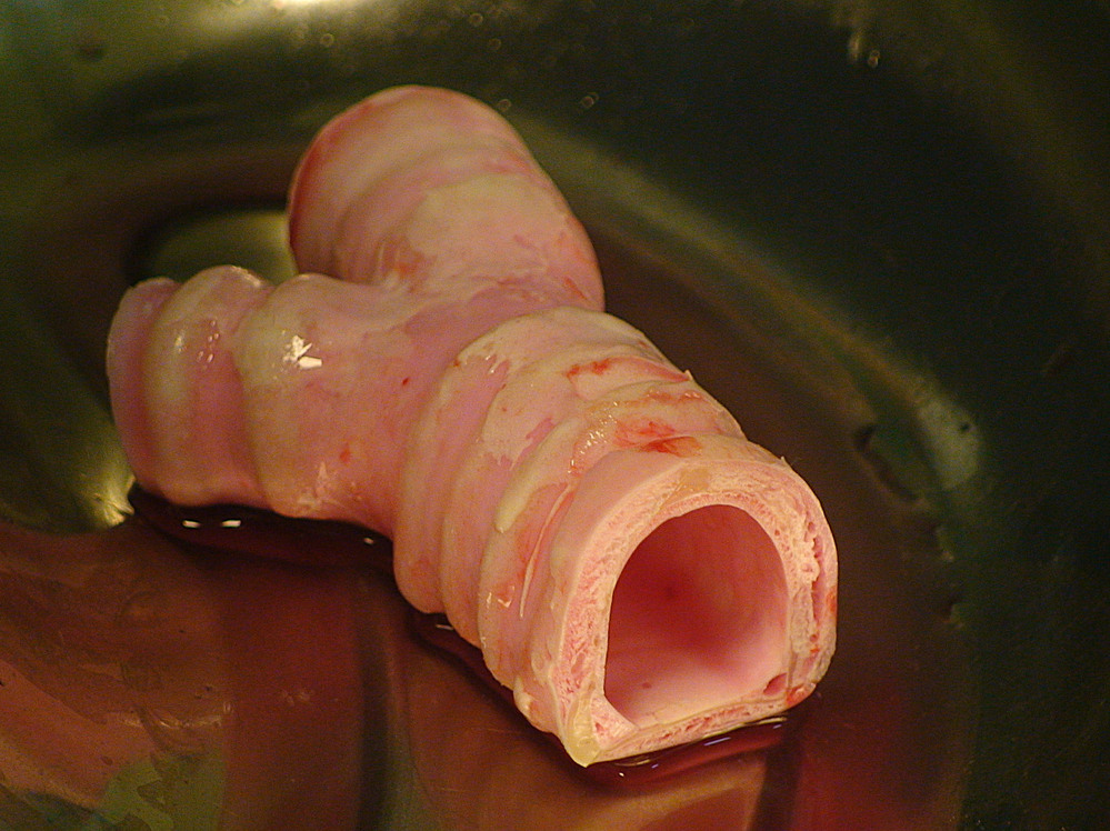 The section of trachea with two days of cell growth, immediately before Castillo's implant surgery.