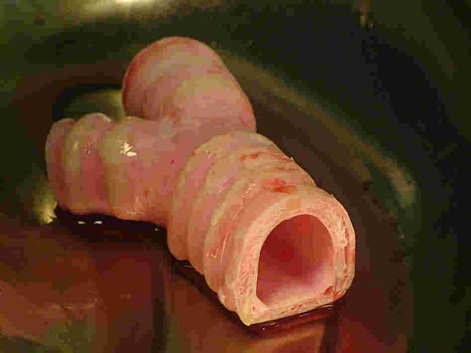 The section of trachea with two days of cell growth, immediately before Castillo's implant surgery.