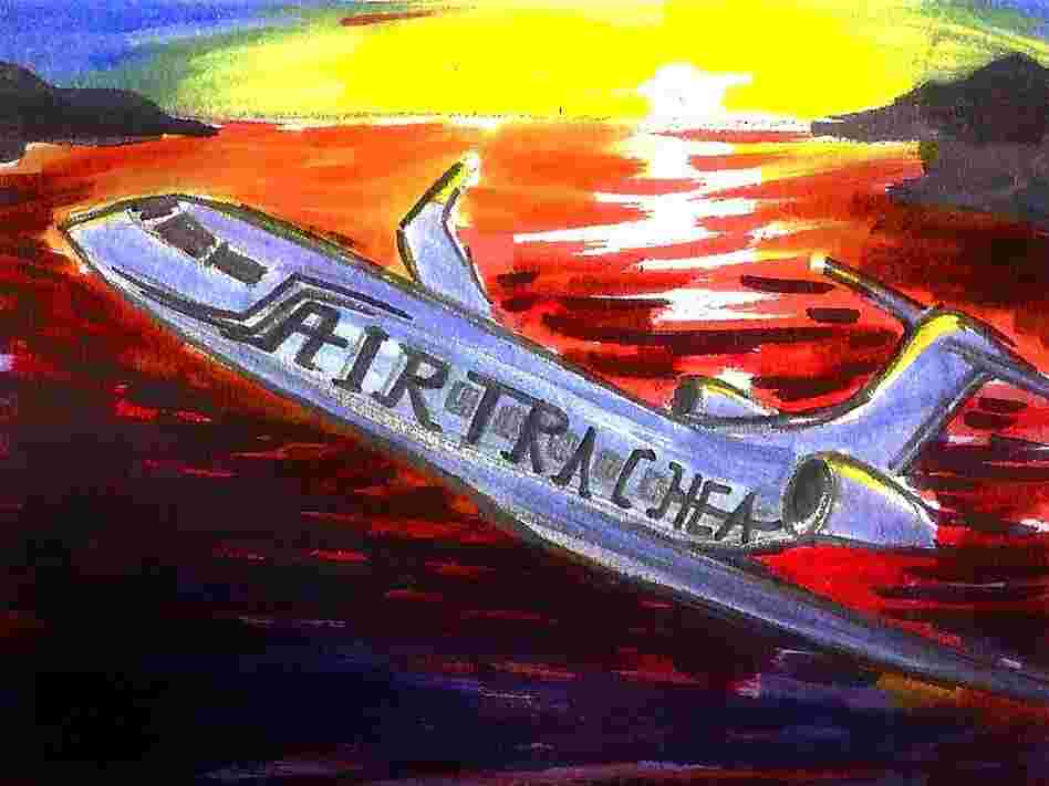 Private jet rushes organs to emergency patient.