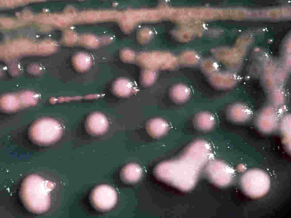 Pretty to look at, almost, but Klebsiella pneumoniae bacteria these are a common cause of infections in hospitals. Pretty to look at, almost, but Klebsiella pneumoniae bacteria these are a common cause of infections in hospitals.