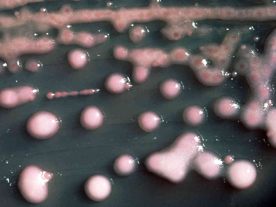 Pretty to look at, almost, but Klebsiella pneumoniae bacteria these are a common cause of infections in hospitals. Pretty to look at, almost, but Klebsiella pneumoniae bacteria these are a common cause of infections in hospitals.