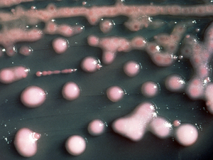 Pretty to look at, almost, but Klebsiella pneumoniae bacteria these are a common cause of infections in hospitals. Pretty to look at, almost, but Klebsiella pneumoniae bacteria these are a common cause of infections in hospitals.