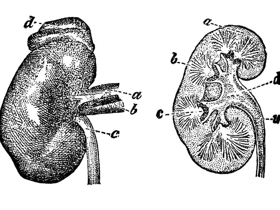 Most living kidney donors return to their daily lives in a matter of weeks, but for some, unforeseen physical and financial complications arise.
