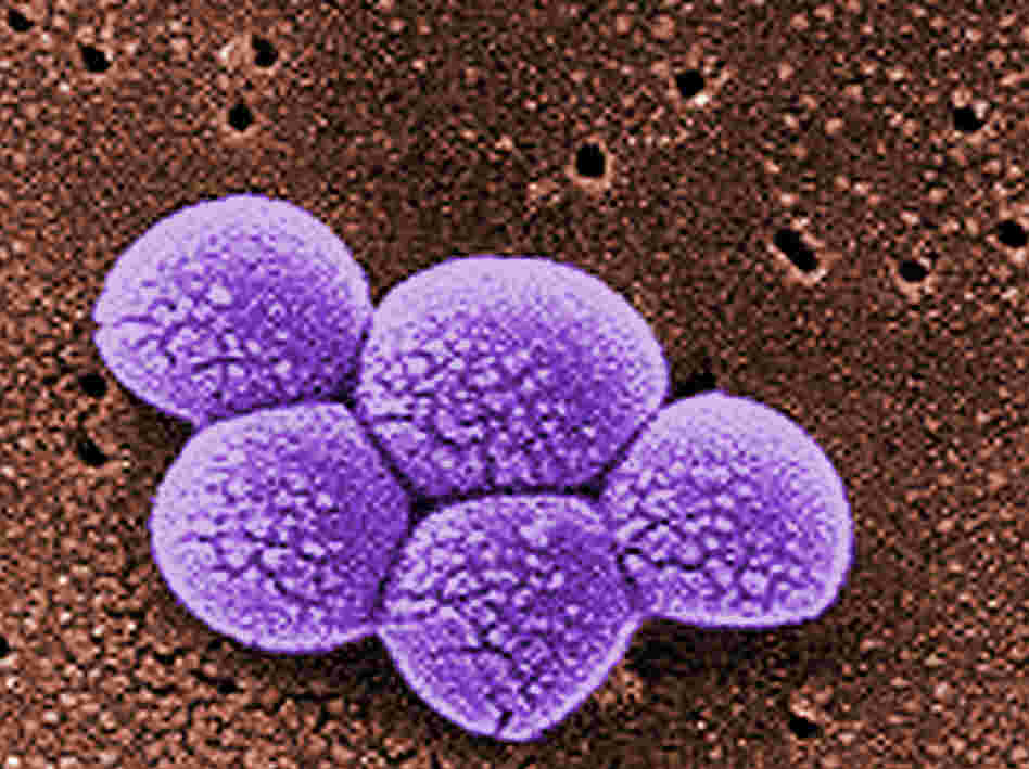 A new lab test could quickly detect methicillin-resistant Staphylococcus aureus, or MRSA, bacteria like these in the blood. A new lab test could quickly detect methicillin-resistant Staphylococcus aureus, or MRSA, bacteria like these in the blood.