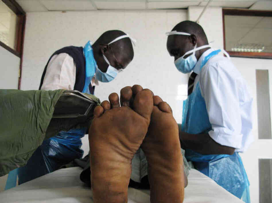 Joseph Ochieng, 18, gets circumcised at the Siaya General Hospital in western Kenya. Joseph Ochieng, 18, gets circumcised at the Siaya General Hospital in western Kenya.