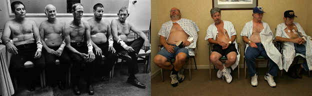 Coal miners in 1976 (left) and 2011 (right) wait to be tested for black lung.