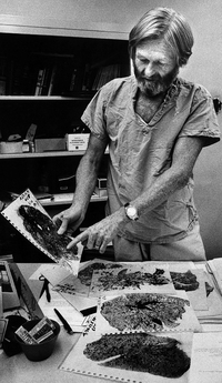 Dr. Donald Rasmussen examines lung sections from coal miners who died from black lung disease in Beckley, W.Va., in 1977. Rasmussen is still the leading black lung doctor in the region.