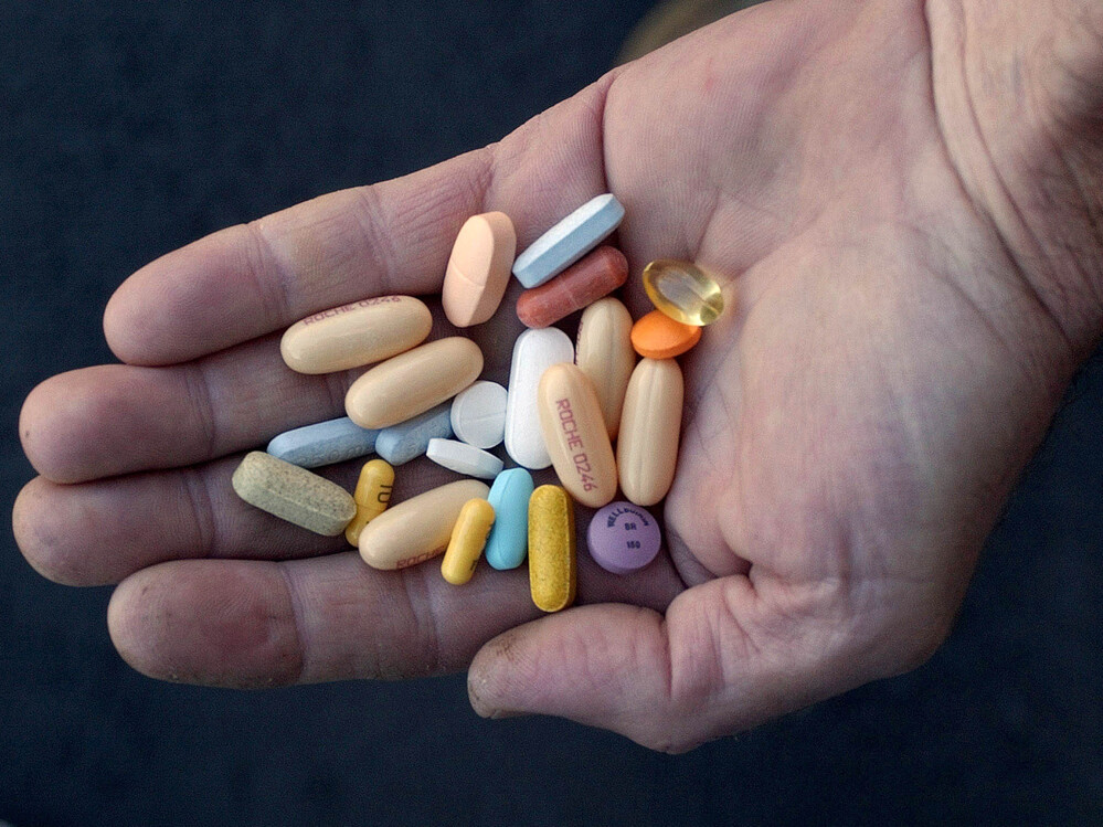 HIV treatment regimens, like the pills in this patient's hand, keep AIDS at bay, but can take a harsh physical toll over the course of many years.