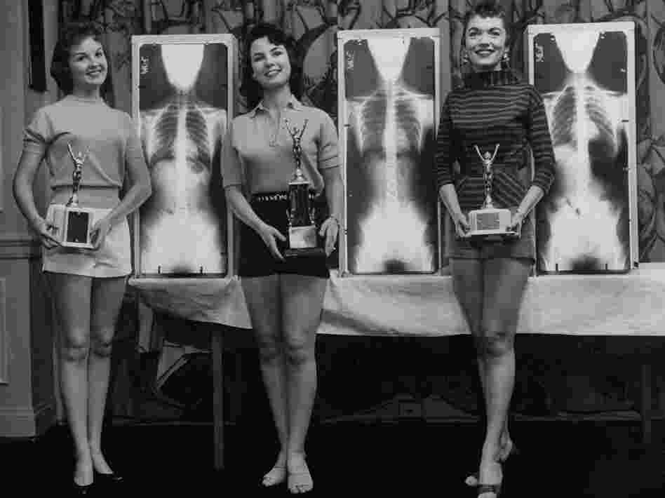 Contestants (from left) Marianne Baba, Lois Conway and Ruth Swenson pose with trophies and their X-rays.