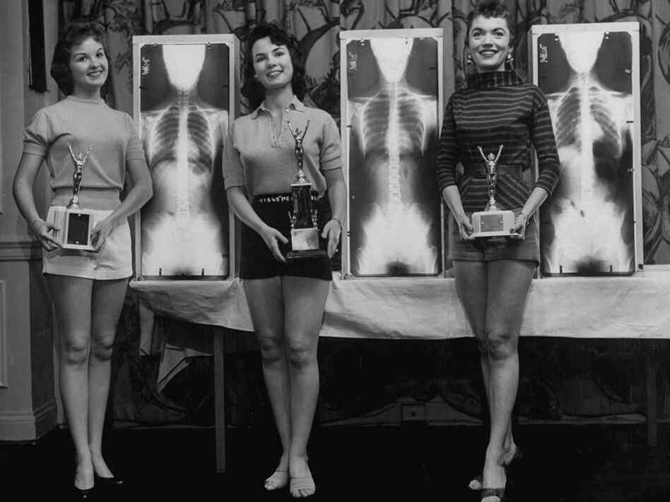 Contestants (from left) Marianne Baba, Lois Conway and Ruth Swenson pose with trophies and their X-rays.