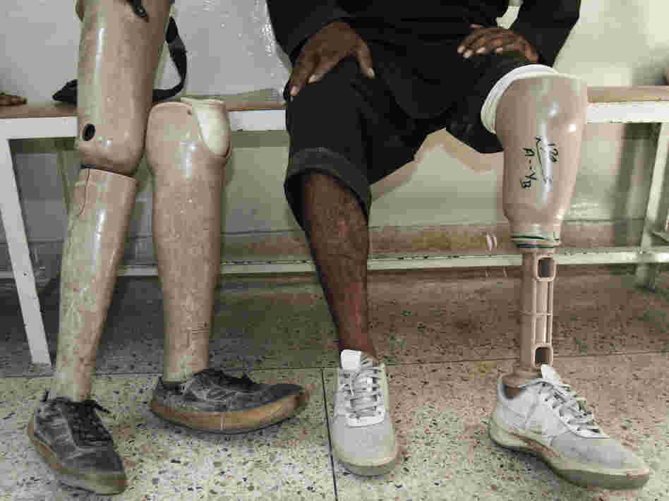An Afghan man rests after walking on his new artificial leg at the International Committee for the Red Cross Ortho Center in the eastern city of Jalalabad, last month. Many Afghans continue to be injured by mines.