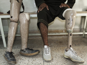 An Afghan man rests after walking on his new artificial leg at the International Committee for the Red Cross Ortho Center in the eastern city of Jalalabad, last month. Many Afghans continue to be injured by mines. An Afghan man rests after walking on his new artificial leg at the International Committee for the Red Cross Ortho Center in the eastern city of Jalalabad, last month. Many Afghans continue to be injured by mines.