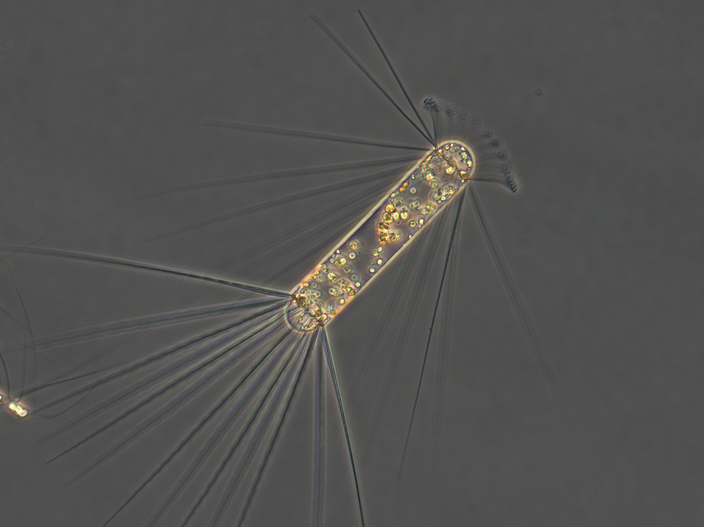 The diatom Corethron pennatum has spines like its related species Chaeotceros atlanticum and Chaeotceros dichaeta. However, this diatom consists of one cell while the other two are cell chains.